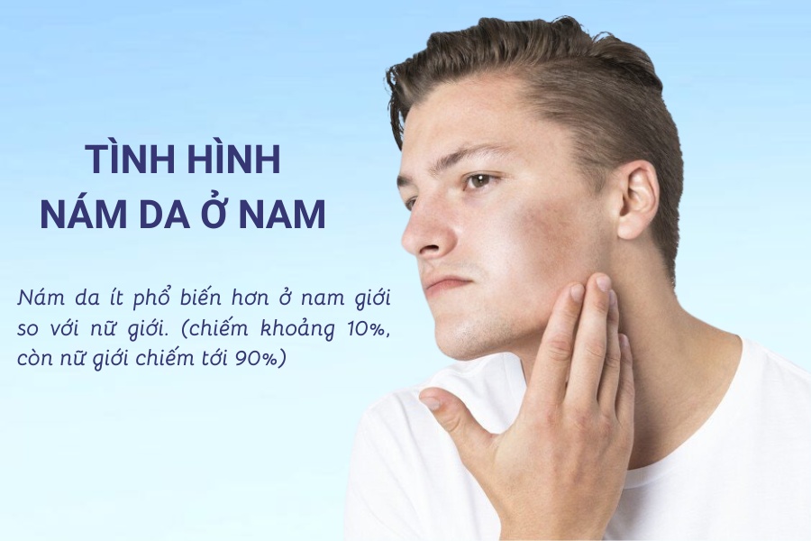Tình trạng nám da thường ít phổ biến ở nam giới nhưng lại ảnh hưởng nghiêm trọng đến chất lượng cuộc sống của họ Tình trạng nám da thường ít phổ biến ở nam giới nhưng lại ảnh hưởng nghiêm trọng đến chất lượng cuộc sống của họ
