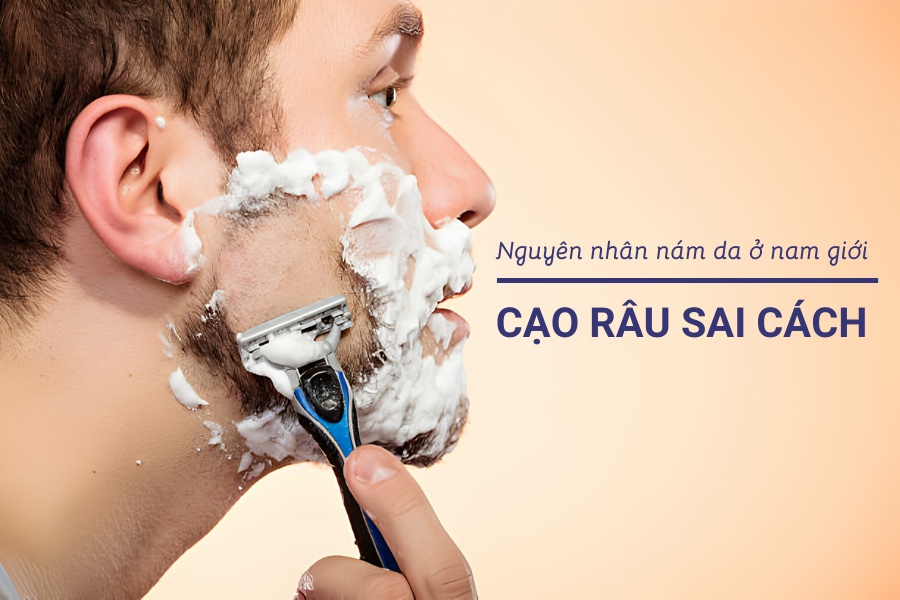 Cạo râu không đúng kỹ thuật là nguyên nhân khiến làm da dễ bị thâm và sạm nám Cạo râu không đúng kỹ thuật là nguyên nhân khiến làm da dễ bị thâm và sạm nám