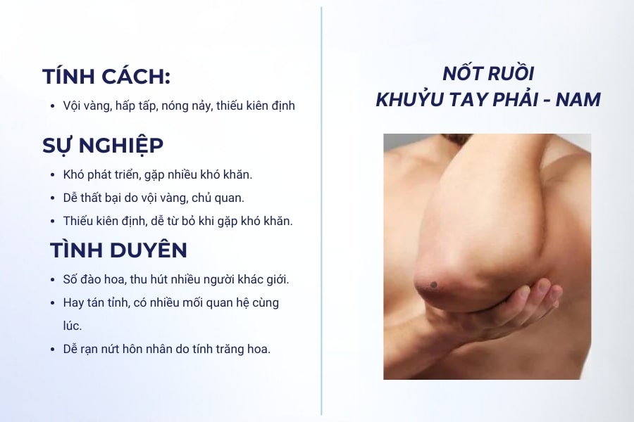 Nốt ruồi khuỷu tay phải nam - Người thiếu kiên định, hấp tấp