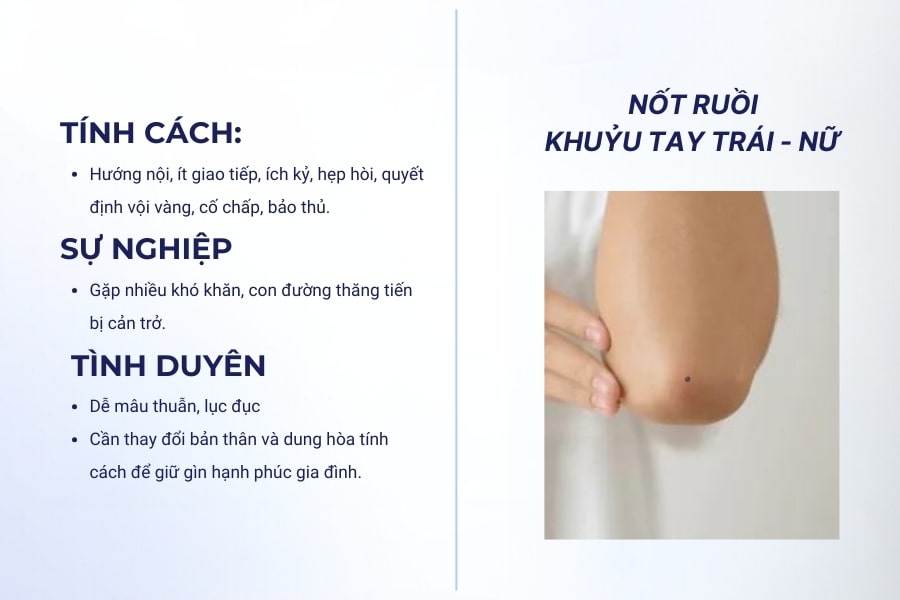 Nốt ruồi khuỷu tay trái nữ - Người hướng nội, hẹp hòi