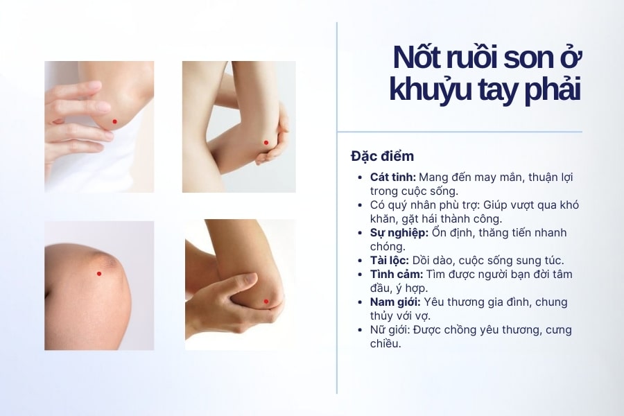 Nốt ruồi son ở khuỷu tay phải - Nốt ruồi cát tinh, mang đến vận may