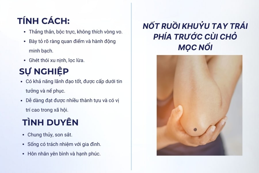 Nốt ruồi khuỷu tay trái phía trước cùi chỏ mọc nổi