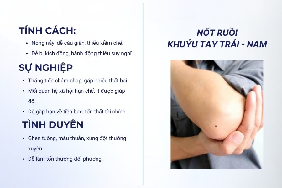 Nốt ruồi ở khuỷu tay trái nam - Người nóng nảy, ghen tuông