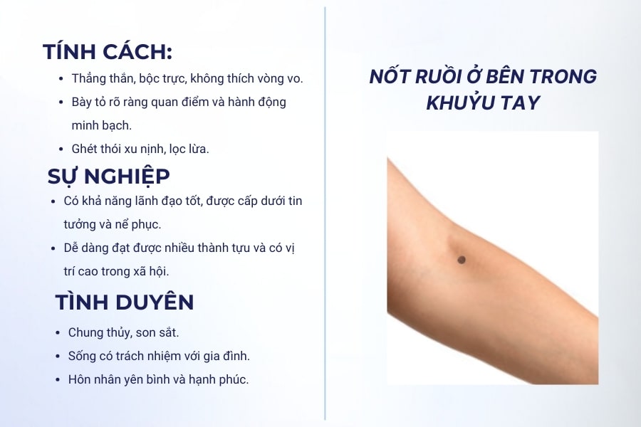 Nốt ruồi ở khuỷu tay mặt trong mang ý nghĩa tốt lành cho người sở hữu