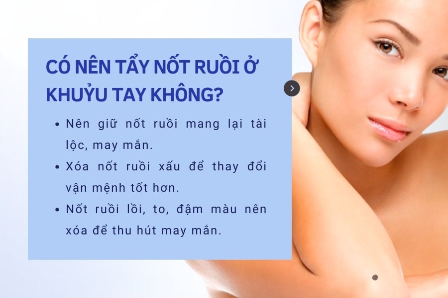 Có nên tẩy nốt ruồi ở khuỷu tay không?