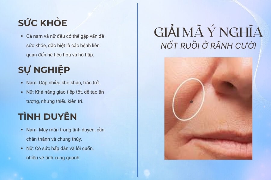 Nốt ruồi ở rãnh cười tốt hay xấu?