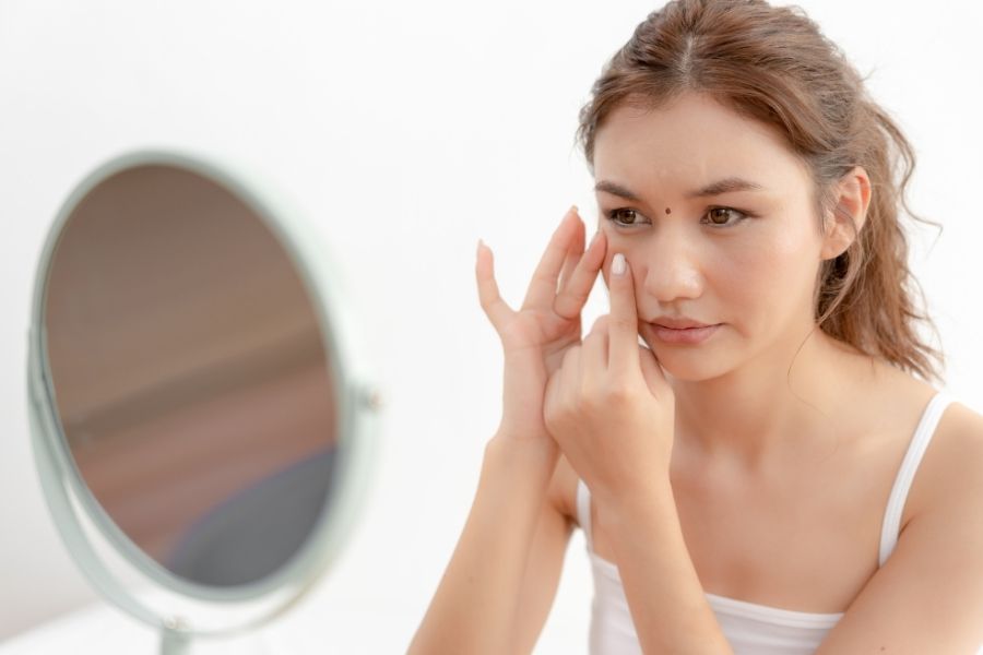 Không nên tự xóa nốt ruồi tại nhà để đảm bảo an toàn cho da Không nên tự xóa nốt ruồi tại nhà để đảm bảo an toàn cho da