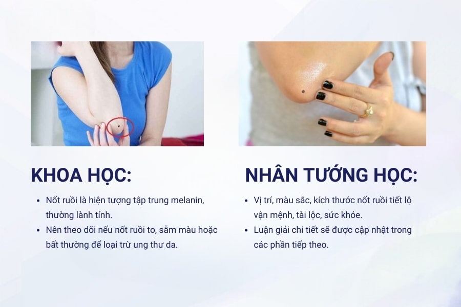 Nốt ruồi ở khuỷu tay nói lên điều gì?