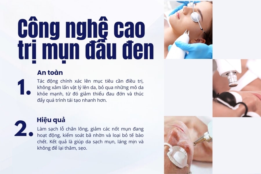 Các biện pháp khác giúp giảm mụn trứng cá