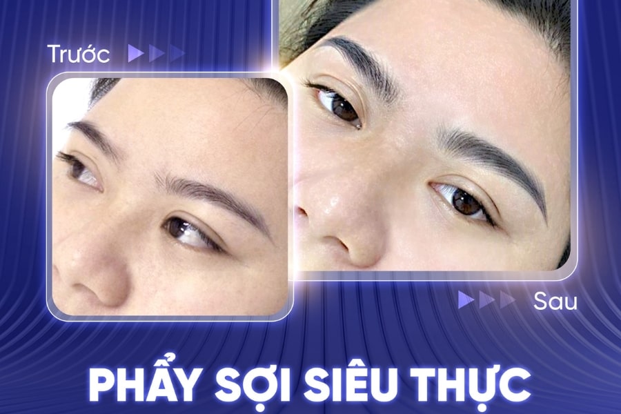 Hình ảnh chân mày của chị khách trước và sau khi đến TMV Ngọc Dung làm dịch vụ phẩy sợi siêu thực Hình ảnh chân mày của chị khách trước và sau khi đến TMV Ngọc Dung làm dịch vụ phẩy sợi siêu thực