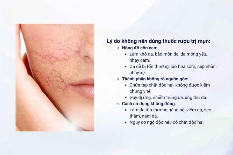 Tại sao thuốc rượu trị mụn lại gây hại cho da? Tại sao thuốc rượu trị mụn lại gây hại cho da?