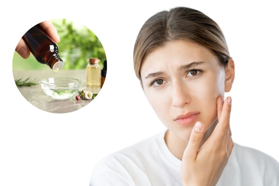 Trị viêm lỗ chân lông ở mặt bằng tràm trà