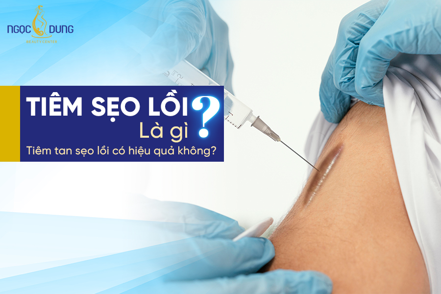 Tiêm sẹo lồi có hiệu quả không? Những ưu nhược điểm của phương pháp này là gì?