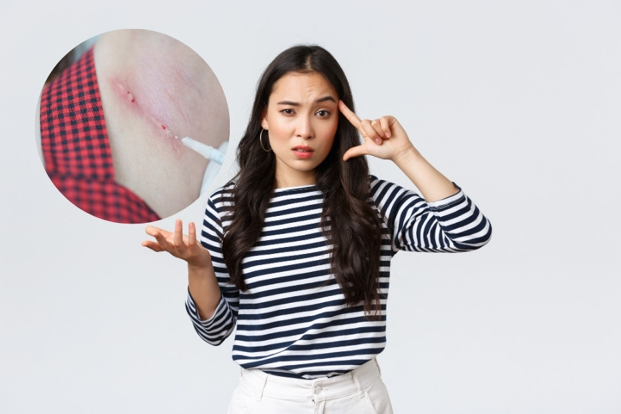 Kết quả tiêm tan sẹo lồi sẽ thấy sau khoảng 2 lần tiêm