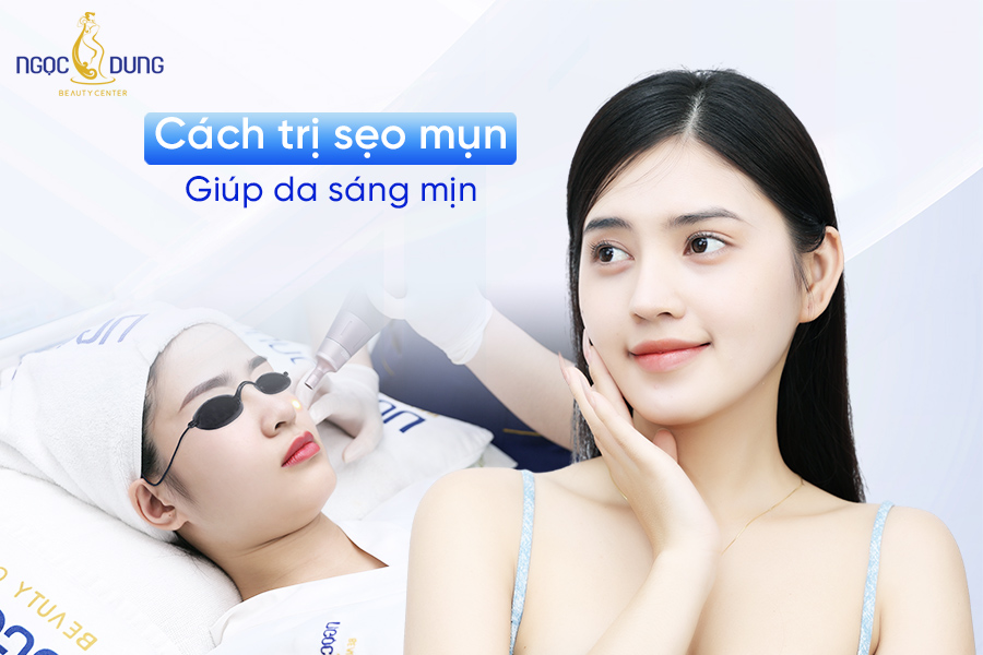 Cách trị sẹo mụn