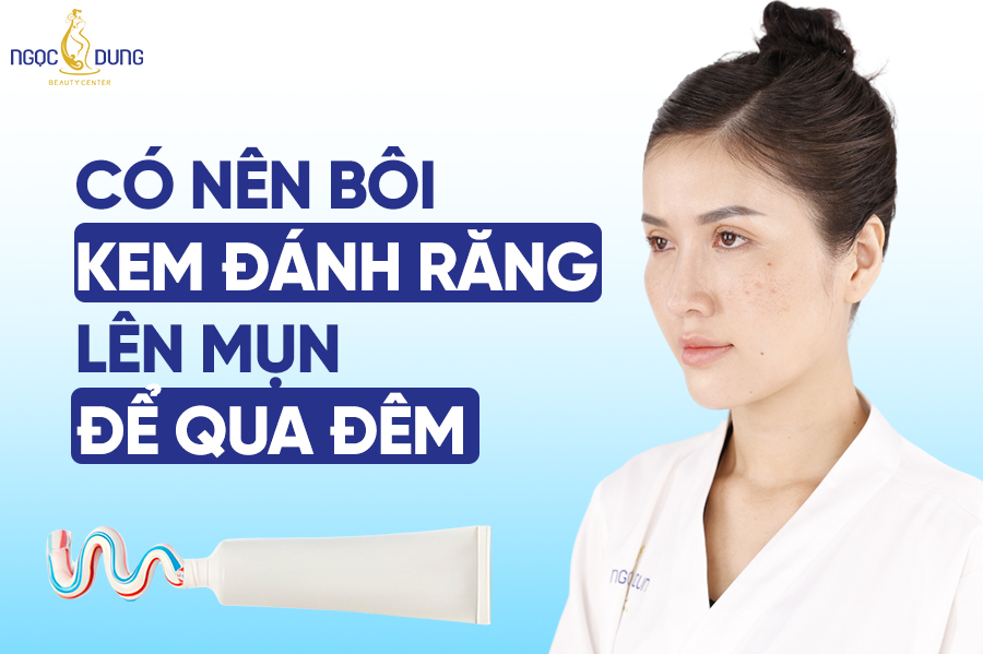 Có nên bôi kem đánh răng lên mụn để qua đêm không? Có tác hại gì?