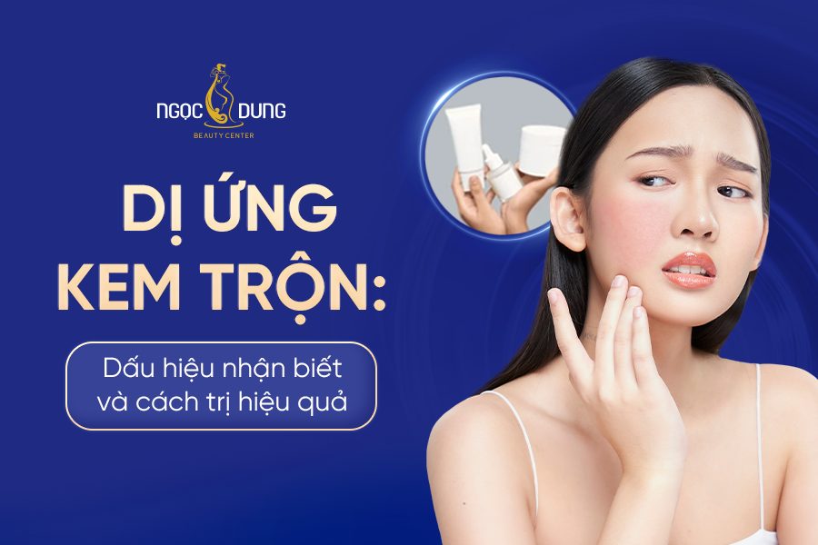 Dị ứng kem trộn