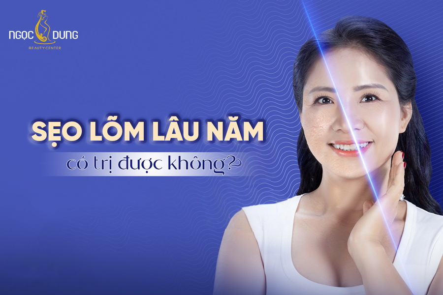 Sẹo lõm lâu năm có trị được không