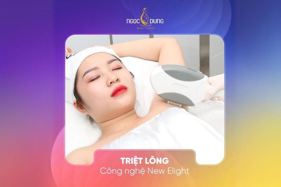 Bôi gì để lông không mọc, loại bỏ lông vĩnh viễn? 4 triet long toan than vinh vien voi cong nghe new elight