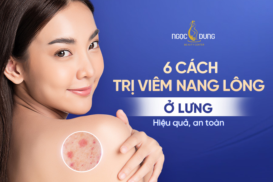 Viêm nang lông lưng
