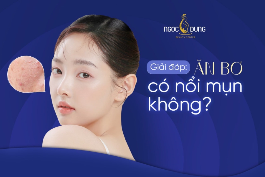 an bo co noi mun khong