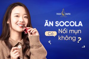 Ăn socola có nổi mụn không? Bí quyết ăn socola tốt cho da mụn