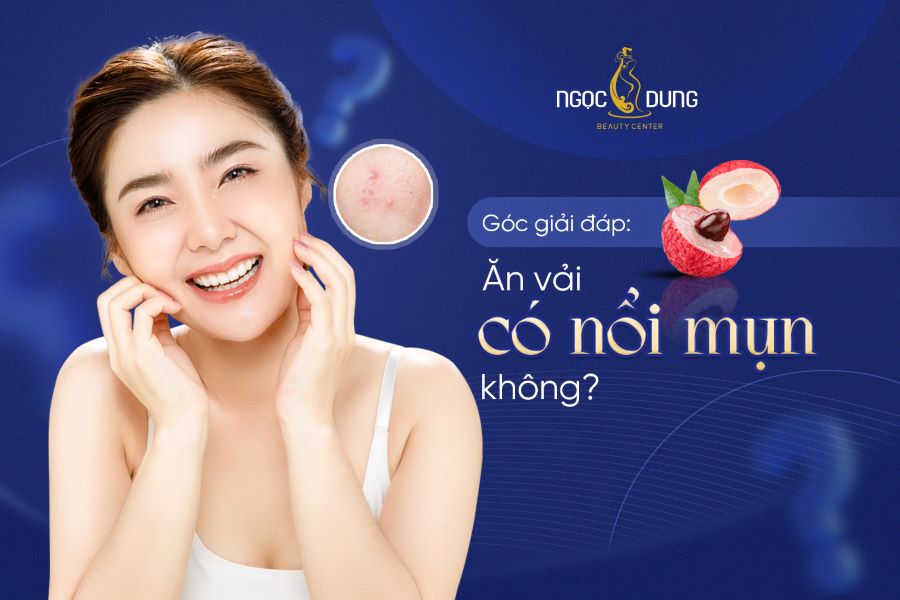 Giải đáp: Ăn vải có nổi mụn không?