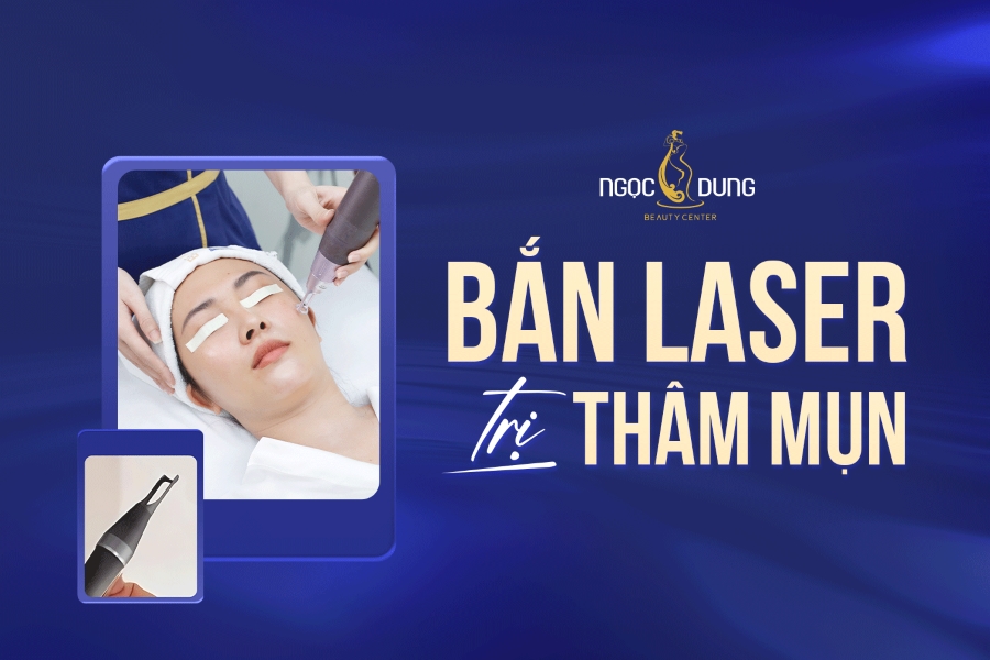 Laser trị thâm mụn: Cơ chế, quy trình và cách chăm sóc