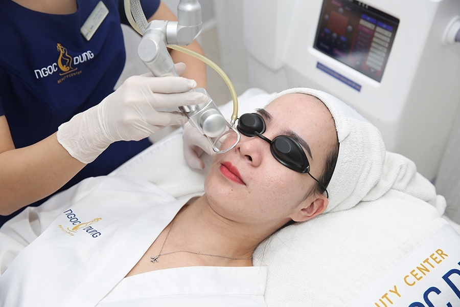 Quy trình xóa vết thâm mụn bằng laser tại TMV Ngọc Dung