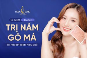 8 Cách trị nám gò má tại nhà, sáng da hiệu quả, ít ai biết