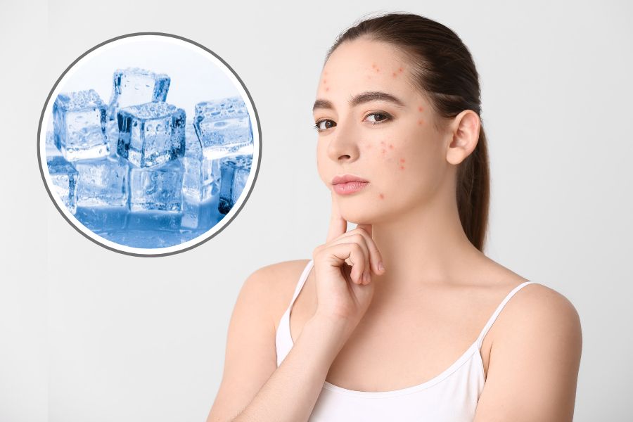 Trị mụn bằng đá lạnh có tốt không? Đá lạnh không có khả năng trị mụn tận gốc