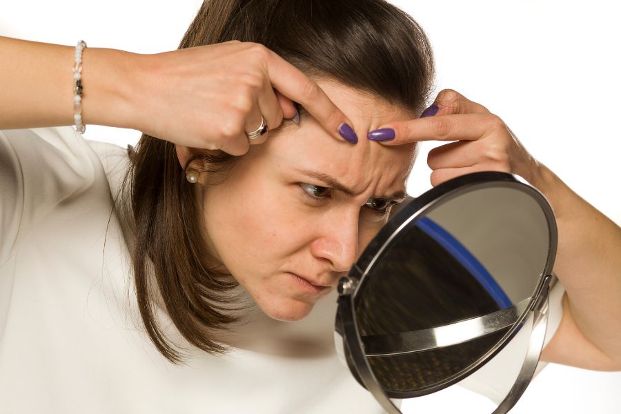 Nặn mụn đầu đen không đúng cách có thể dẫn đến tổn thương da, hình thành sẹo lồi, sẹo lõm