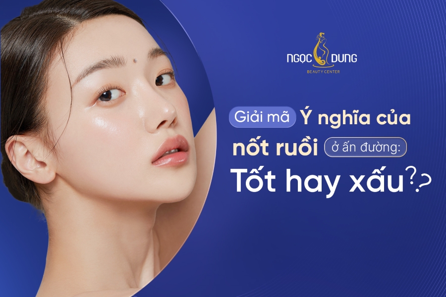 Giải mã ý nghĩa nốt ruồi ở ấn đường: Tốt hay xấu? Phúc hay họa