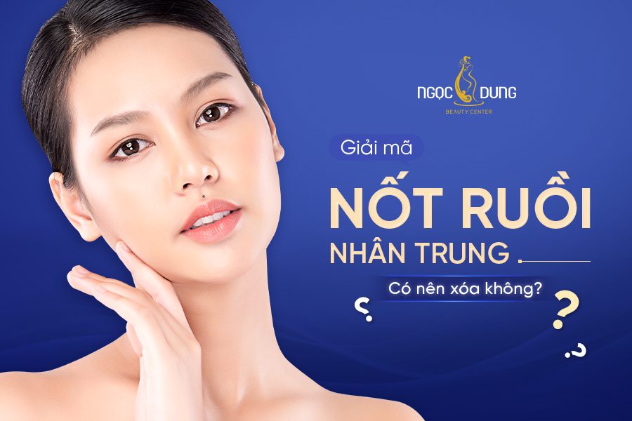 Ý nghĩa nhân tướng học nốt ruồi ở nhân trung tốt hay xấu?