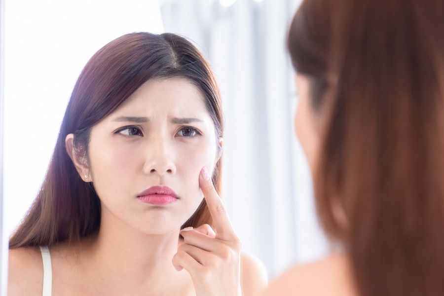 Một số tác dụng phụ thường gặp khi Peel da TCA Một số tác dụng phụ thường gặp khi Peel da TCA