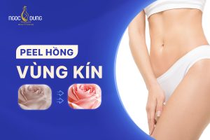 Giải đáp: Peel hồng vùng kín có an toàn và hiệu quả hay không?