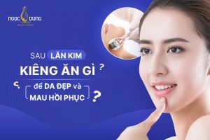 Sau khi lăn kim kiêng ăn gì để da đẹp và nhanh hồi phục?
