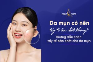 Hướng dẫn cách tẩy tế bào chết cho da mụn đơn giản tại nhà