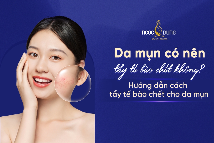 Hướng dẫn cách tẩy tế bào chết cho da mụn đơn giản tại nhà