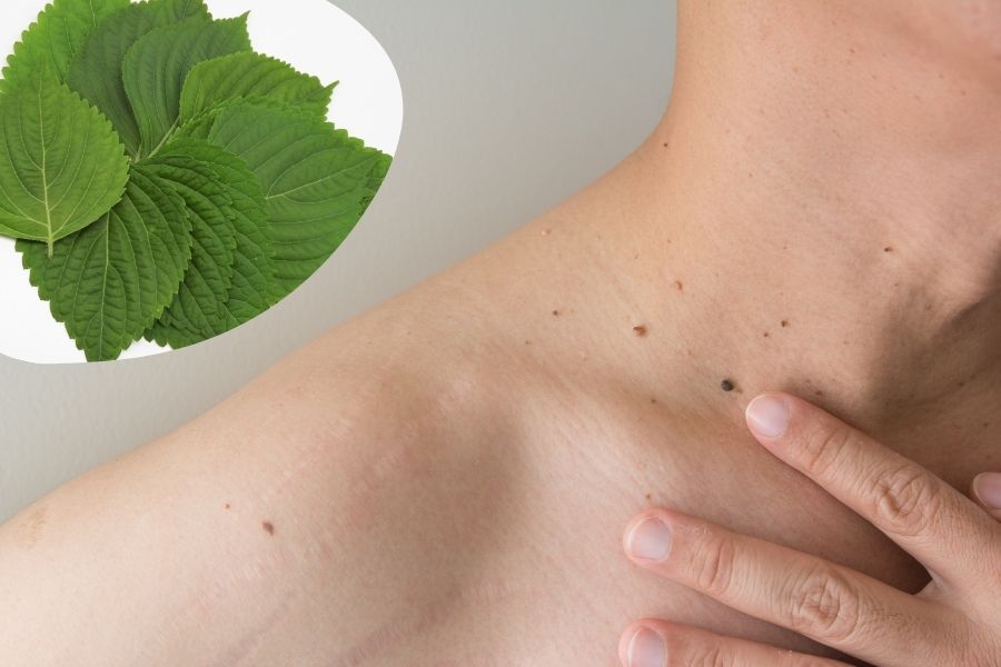 Hàm lượng tinh dầu có trong lá tía tô giúp kháng khuẩn và trị mụn thịt hiệu quả Hàm lượng tinh dầu có trong lá tía tô giúp kháng khuẩn và trị mụn thịt hiệu quả