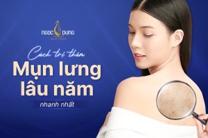 8 bí quyết trị thâm mụn lưng an toàn, hiệu quả cấp tốc tại nhà