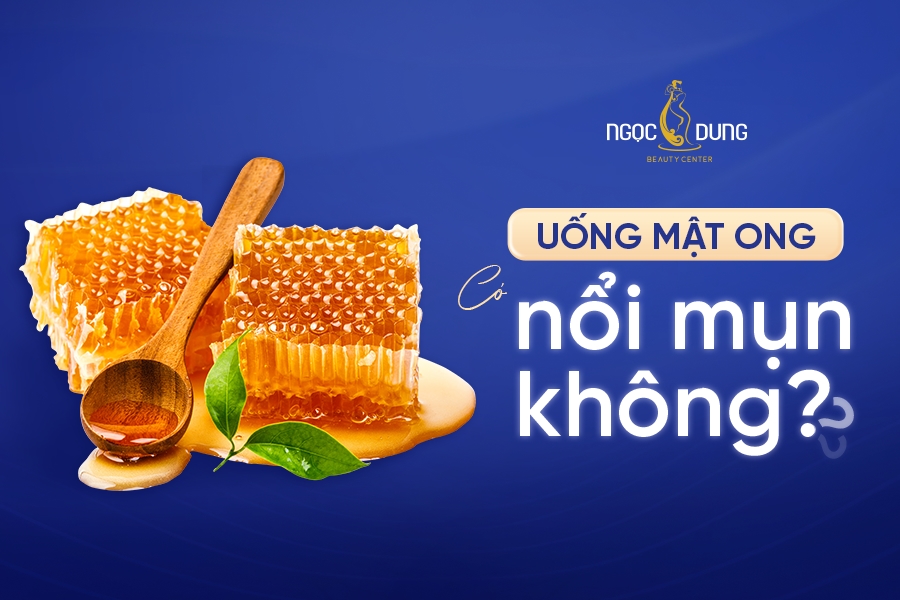 Uống mật ong có nổi mụn không? Có gây nóng trong người?