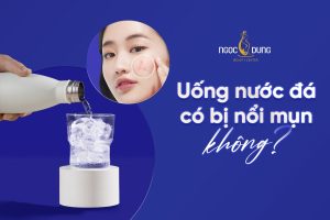 Uống nước đá có bị nổi mụn không? Có gây nóng không?