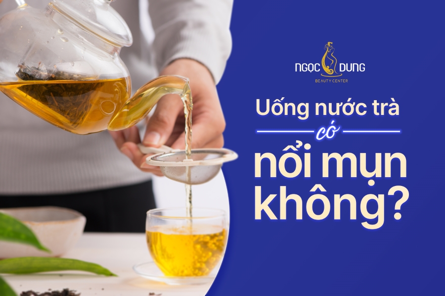 Uống trà có nổi mụn không? Các loại trà tốt cho da bị mụn