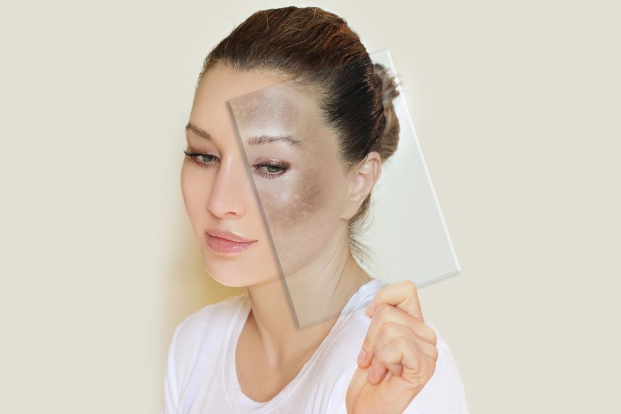 Một số cách để tránh những tác hại của kem trị nám da Một số cách để tránh những tác hại của kem trị nám da