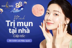 TOP 10+ cách trị mụn tại nhà cấp tốc, an toàn và hiệu quả