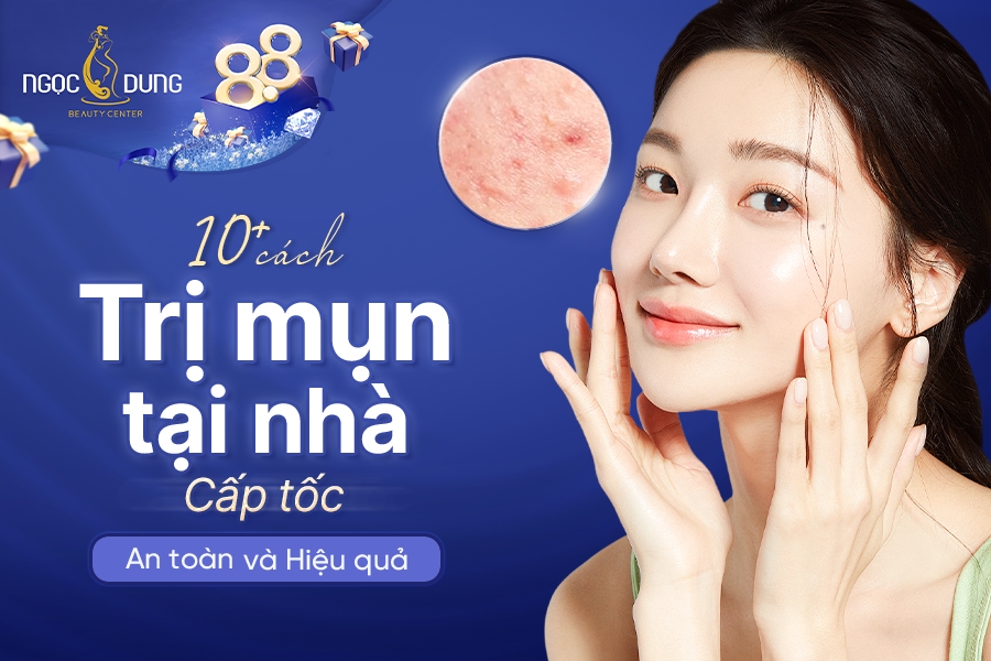 TOP 10+ cách trị mụn tại nhà cấp tốc, an toàn và hiệu quả