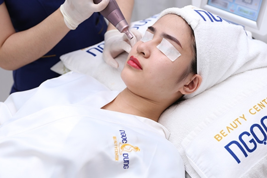 Quá trình trị mụn không có viêm tại Hệ thống Thẩm mỹ viện Ngọc Dung