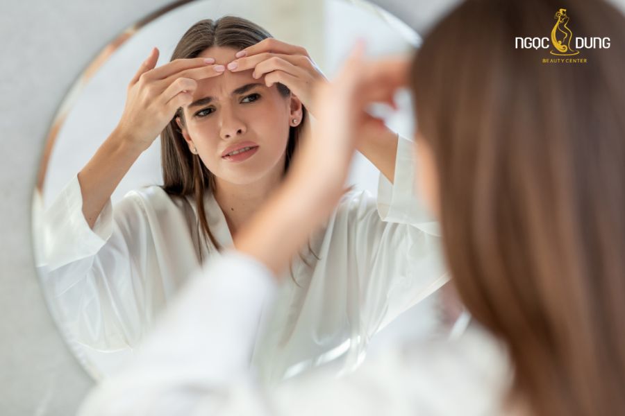 Lưu ý khi trị mụn thâm cho bà bầu