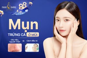 Mụn trứng cá ở mũi: Dấu hiệu, nguyên nhân và cách điều trị